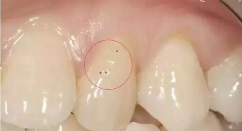 汽车抛光牙齿价格多少