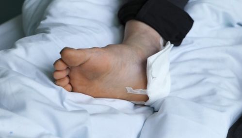 老人被毒蛇咬伤：医生说比骨折还痛