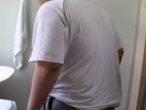 周杰伦患强直性脊柱炎 近照弯腰驼背